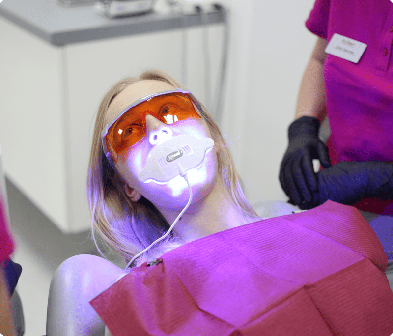Відбілювання зубів у Львові